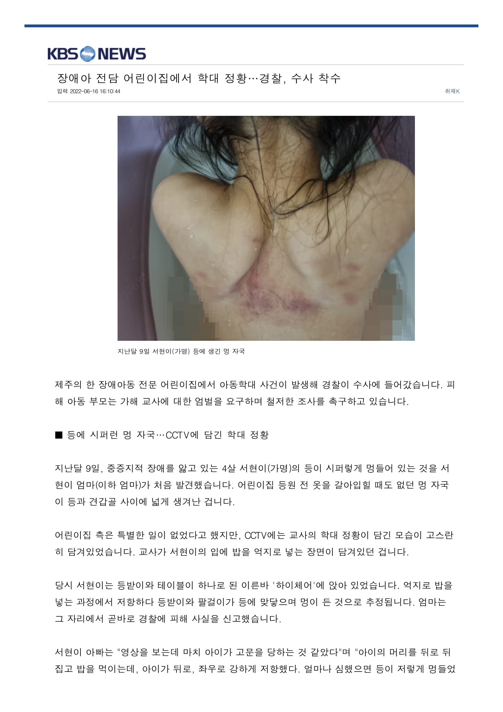 장애아 전담 어린이집에서 학대 정황…경찰, 수사 착수-1.jpg