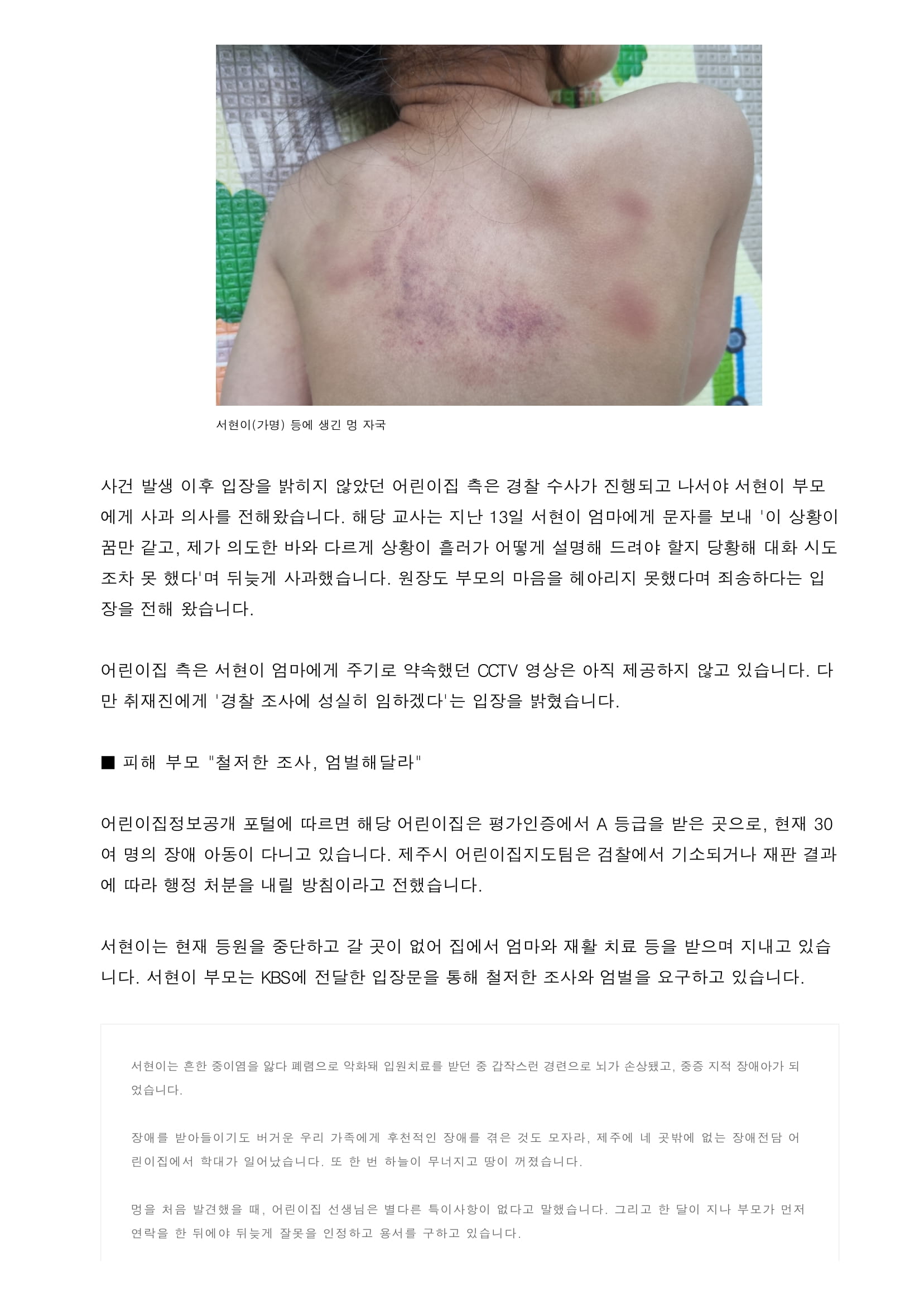 장애아 전담 어린이집에서 학대 정황…경찰, 수사 착수-3.jpg